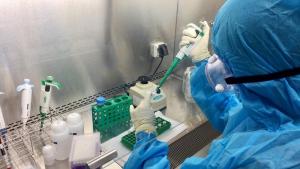 Bệnh viện Trường Đại học Y Dược Huế triển khai thực hiện xét nghiệm RT-PCR chẩn đoán Covid-19